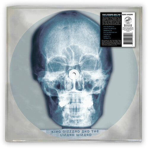Skull X-Ray